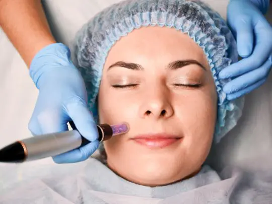 Mezoterapia mikroigłowa