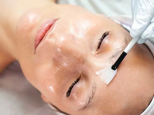 Peelingi chemiczne z wykorzystaniem kwasów